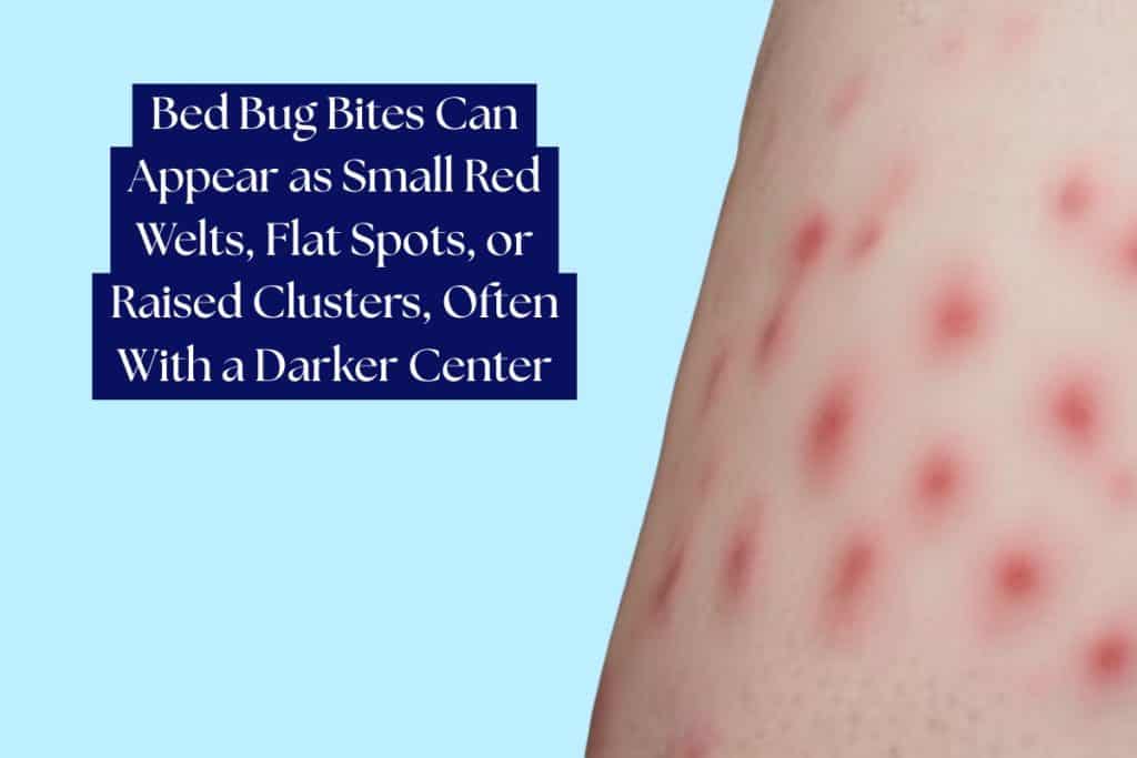 How To Check For Bed Bugs (Signs And Inspection Tips) 2